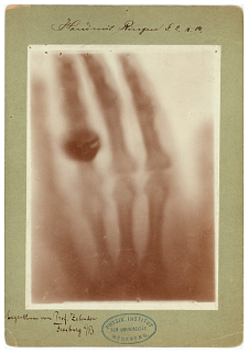Aufnahme eines Versuchs zur Durchleuchtung einer menschlichen Hand mit Ringen. (c) Deutsches Röntgen Museum