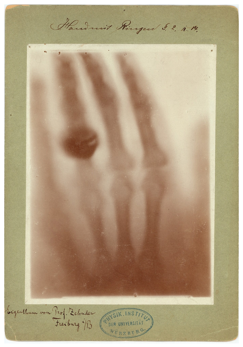 Aufnahme eines Versuchs zur Durchleuchtung einer menschlichen Hand mit Ringen. (c) Deutsches Röntgen Museum